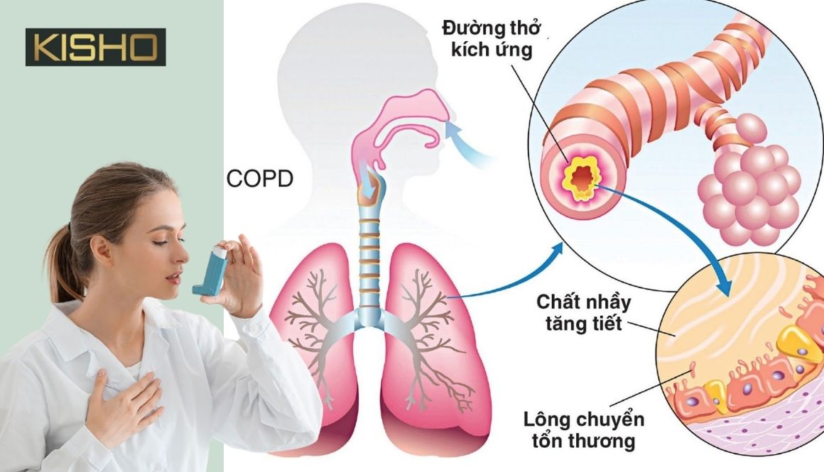 hen-phe-quan-man-tinh-la-gi (1)