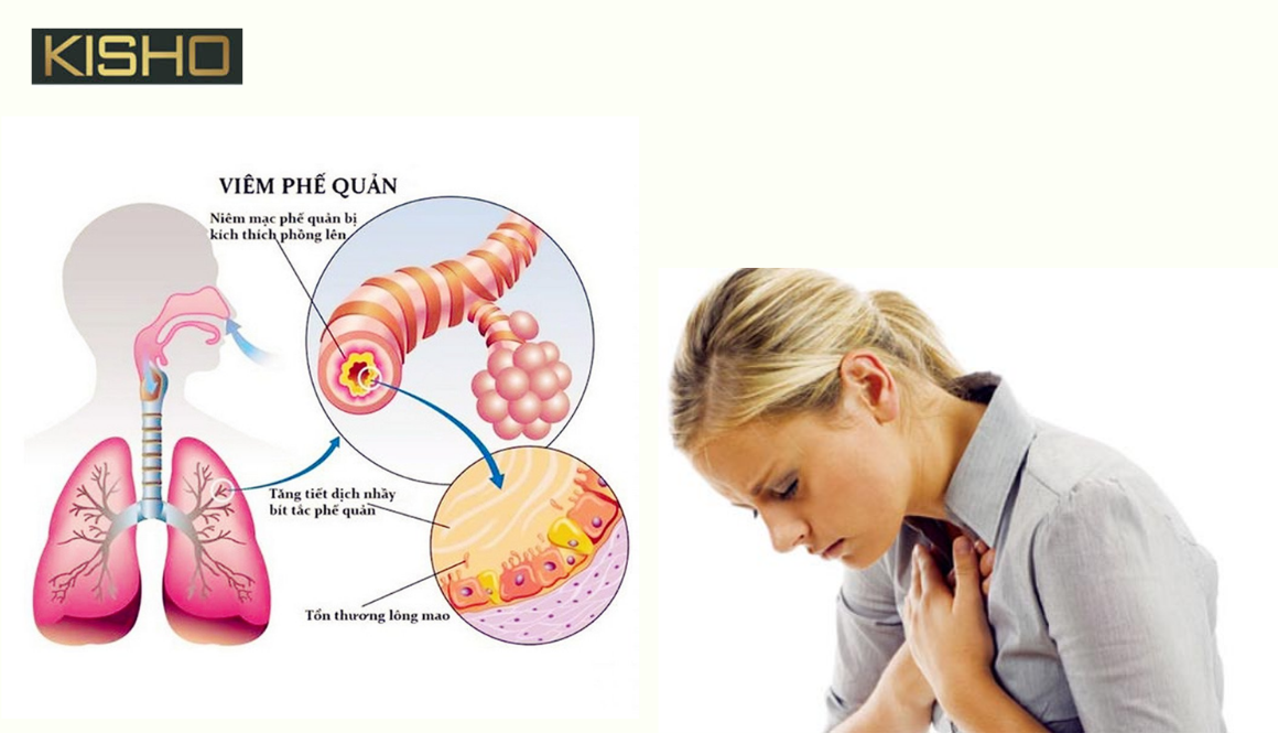 Bệnh hen suyễn có lây không?