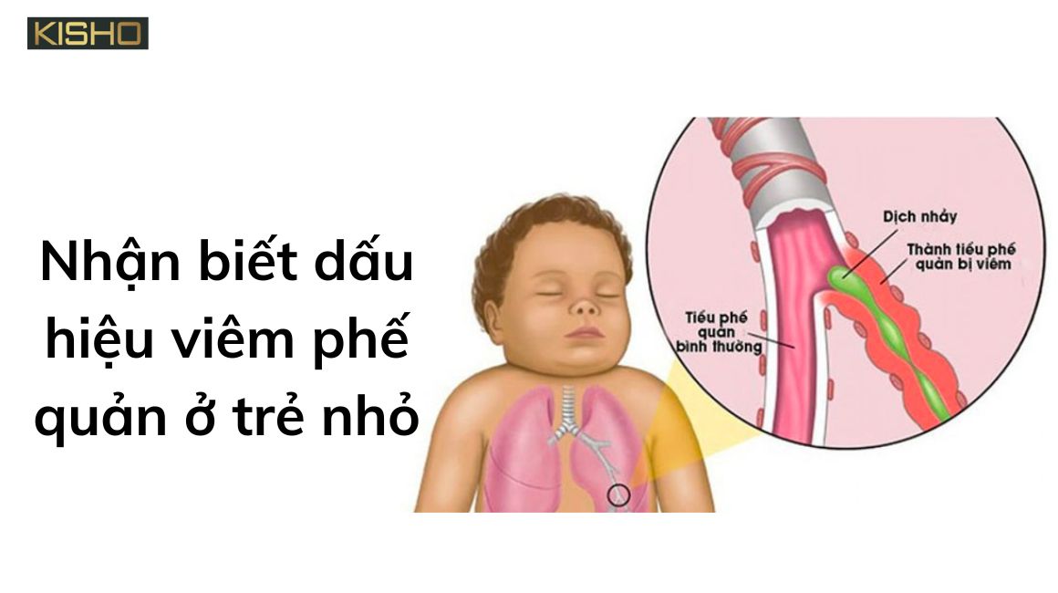 dau-hieu-viem-phe-quan-o-tre-nho-1