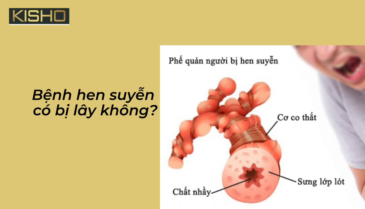 Bệnh hen suyễn có bị lây không?