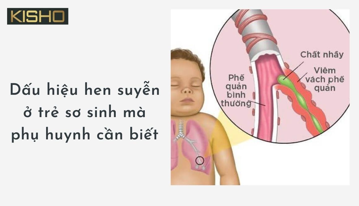 Dấu hiệu hen suyễn ở trẻ sơ sinh