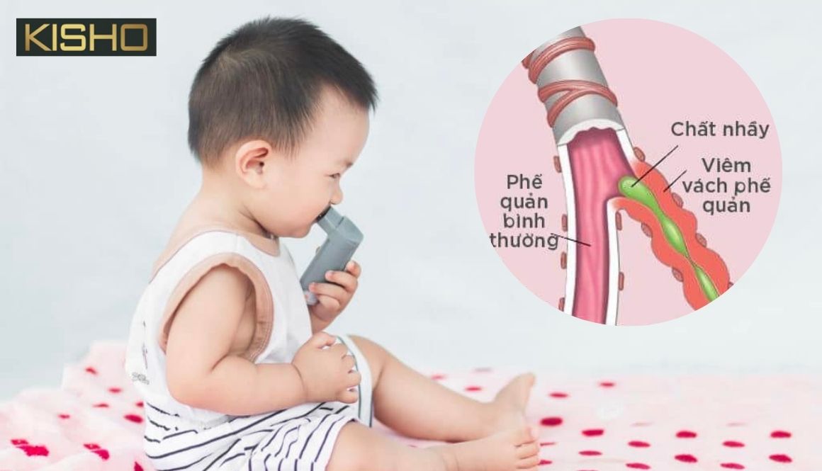 nguyen-nhan-hen-suyen-tre-so-sinh-122